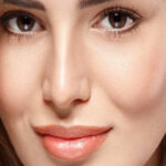 تزریق فیلر گونه در کرج + برجسته‌ سازی گونه در کرج